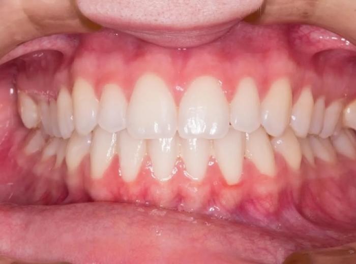 The Importance of Gum Health: How It Affects Your Overall Well-Being